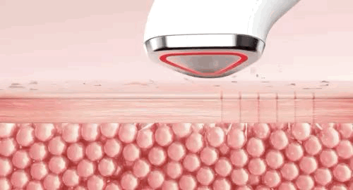 21 - Dr. Tengle Hyper Booster