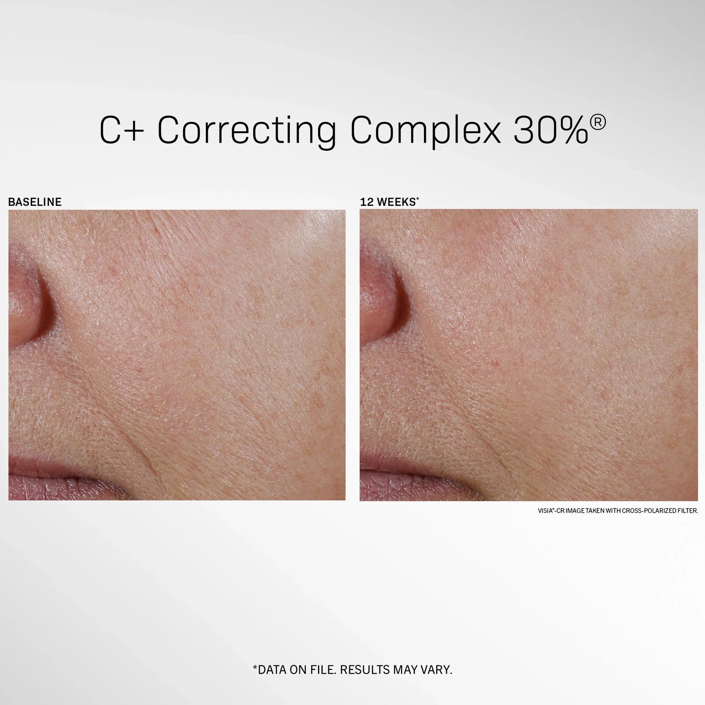 9 - Revision Vit C+ Correcting Complex 30%
