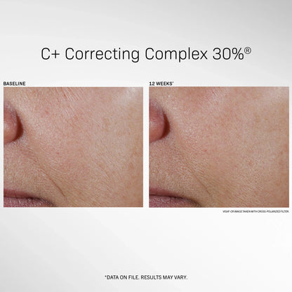 9 - Revision Vit C+ Correcting Complex 30%