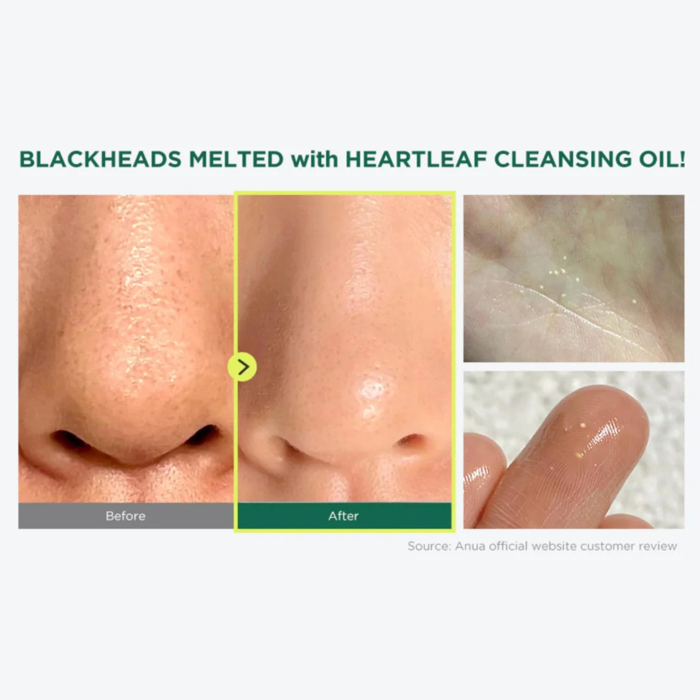 Limpiador Facial Control de Poros Heartleaf