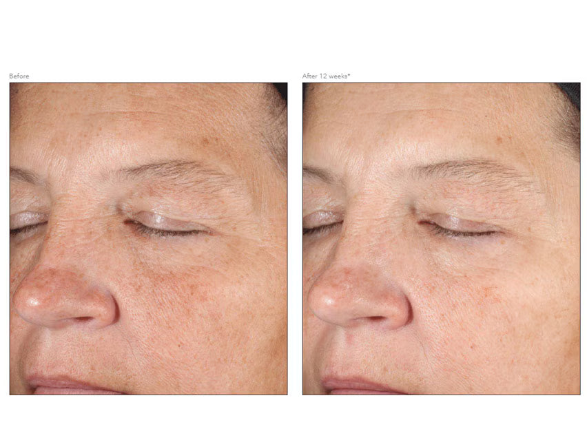 11 - Revision D·E·J Face Cream