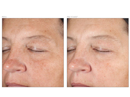 11 - Revision D·E·J Face Cream